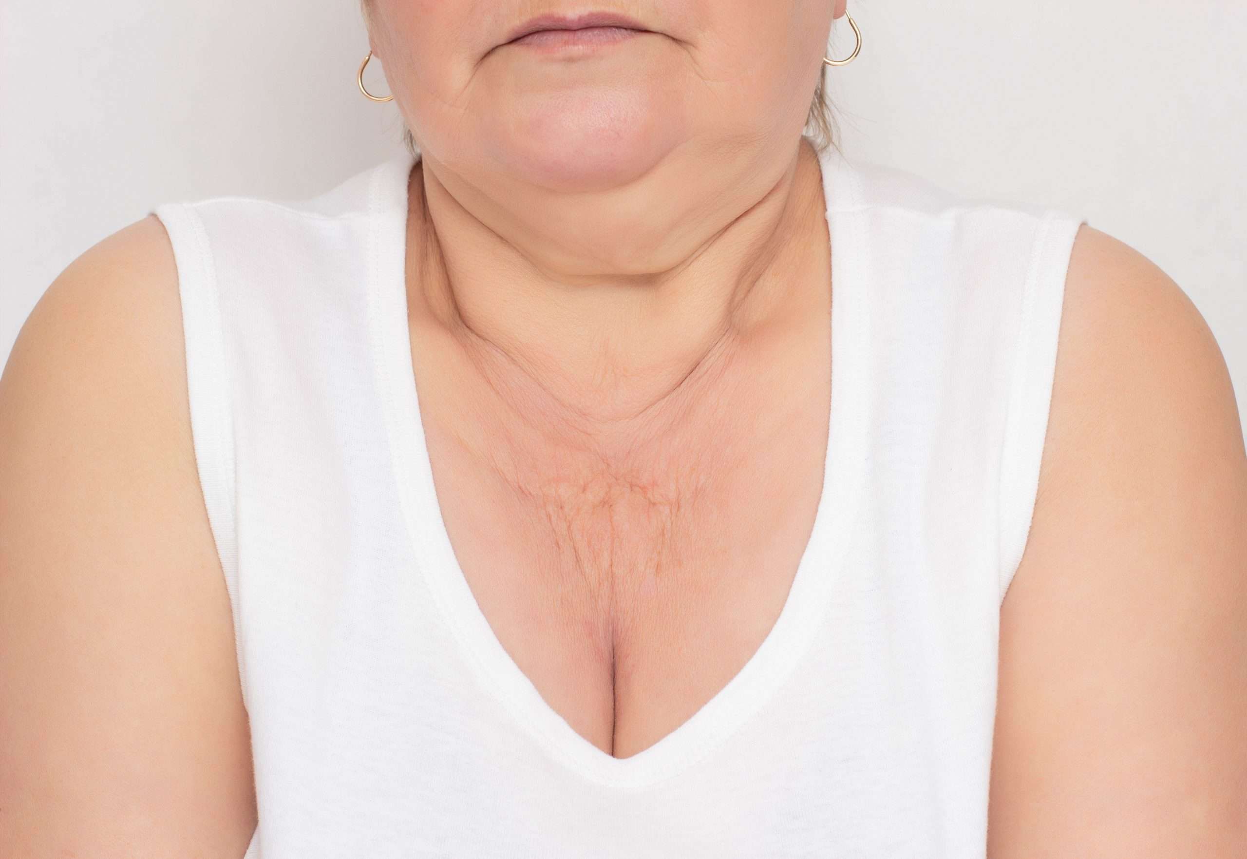 before picture of patient before chest rejuvenation procedure