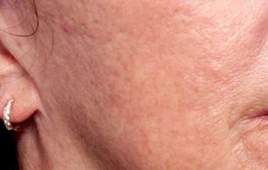 After-Courtesy of Guy Cappucino, MD