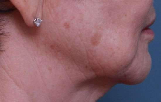 After-Courtesy of JW Choi, MD