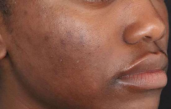 After-Courtesy of Zena Gabriel, MD