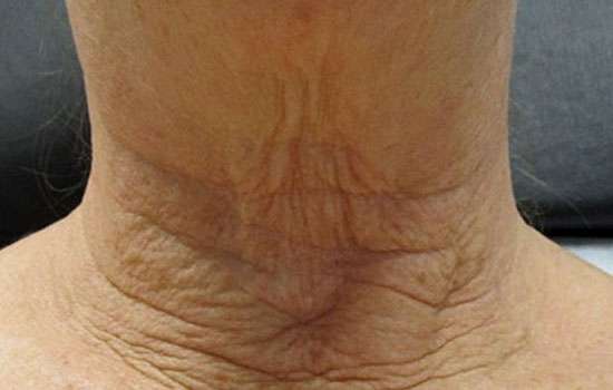 Before-Courtesy of Joely Kaufman, MA