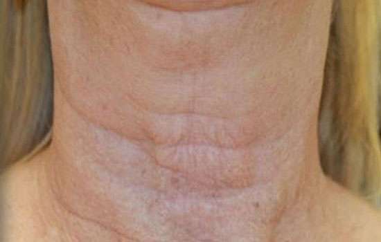 After-Courtesy of Joely Kaufman, MA