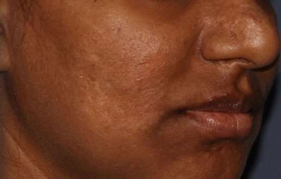 After-Courtesy of Swapnil Shah, MD