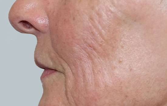 Before-Courtesy of Steven Weiner, MD