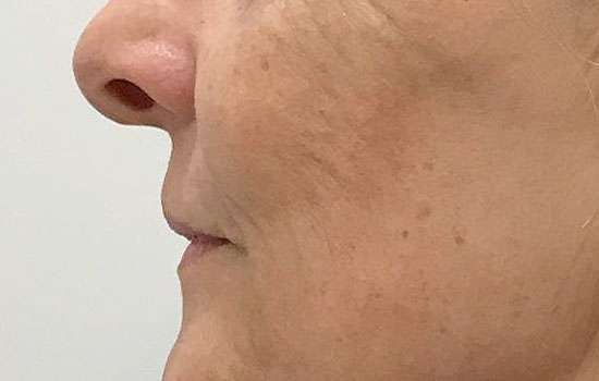 After-Courtesy of Steven Weiner, MD