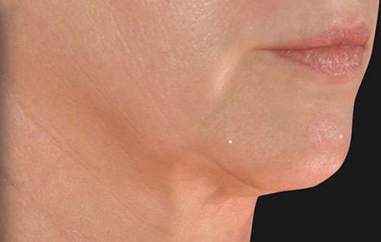 After-Courtesy of Steven Weiner, MD