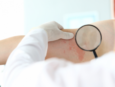 dermatological care for georgia resident