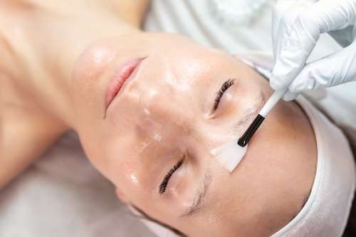 Chemical Peels In Macon Georgia