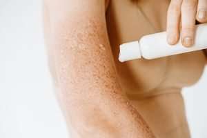 Tips to Help Heal Sun Damage? - Skin Care Physicians Tips to Help Heal Sun Damage