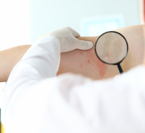 doctor examining atopic dermatitis on patient in GA