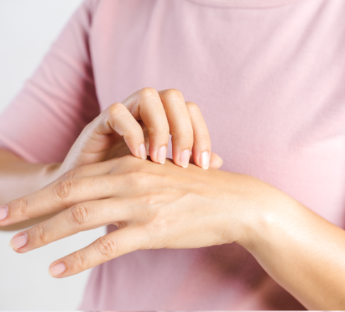 women with itchy skin from atopic dermatitis